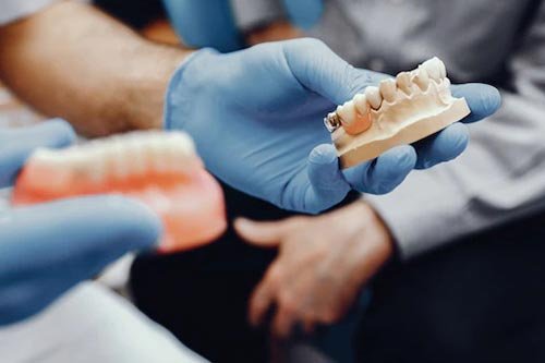 ajustes na prótese dentária