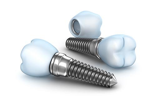 implante dentário