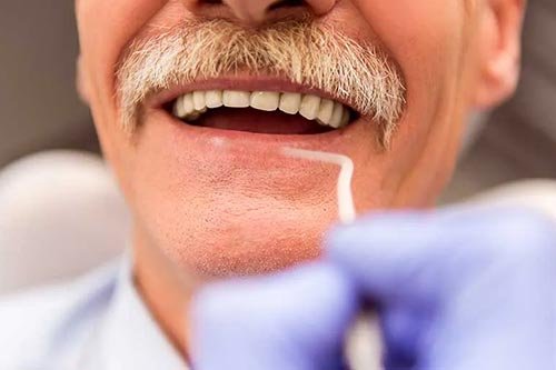 limpeza dentária em idosos
