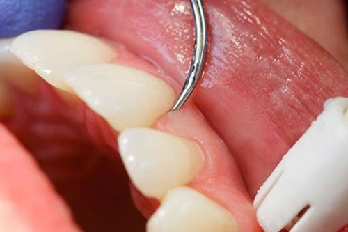 periodontia em idosos